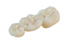 Prosthodontic-Dental-Udaipur-rajasthan
